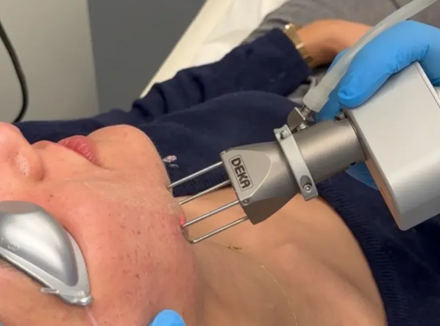 οδηγίες μετά το fractional laser