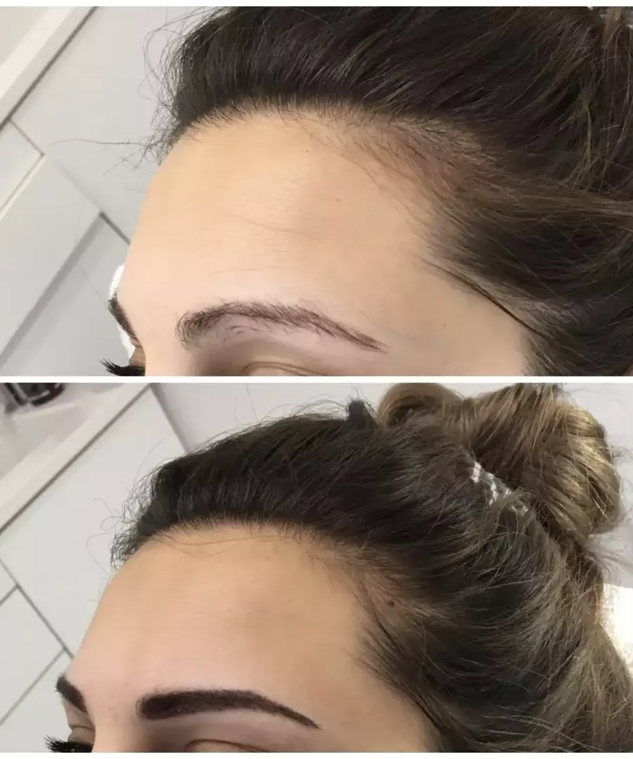 Πριν και μετά το microblading στα φρύδια.