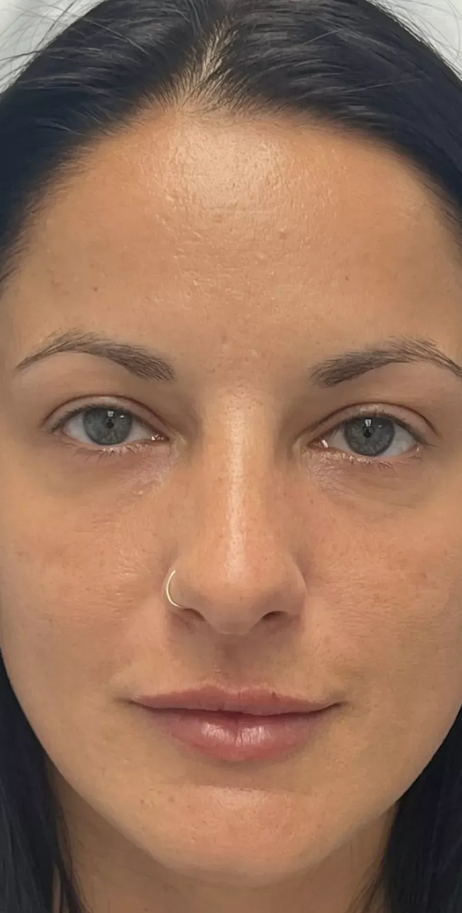 Case 1 — after