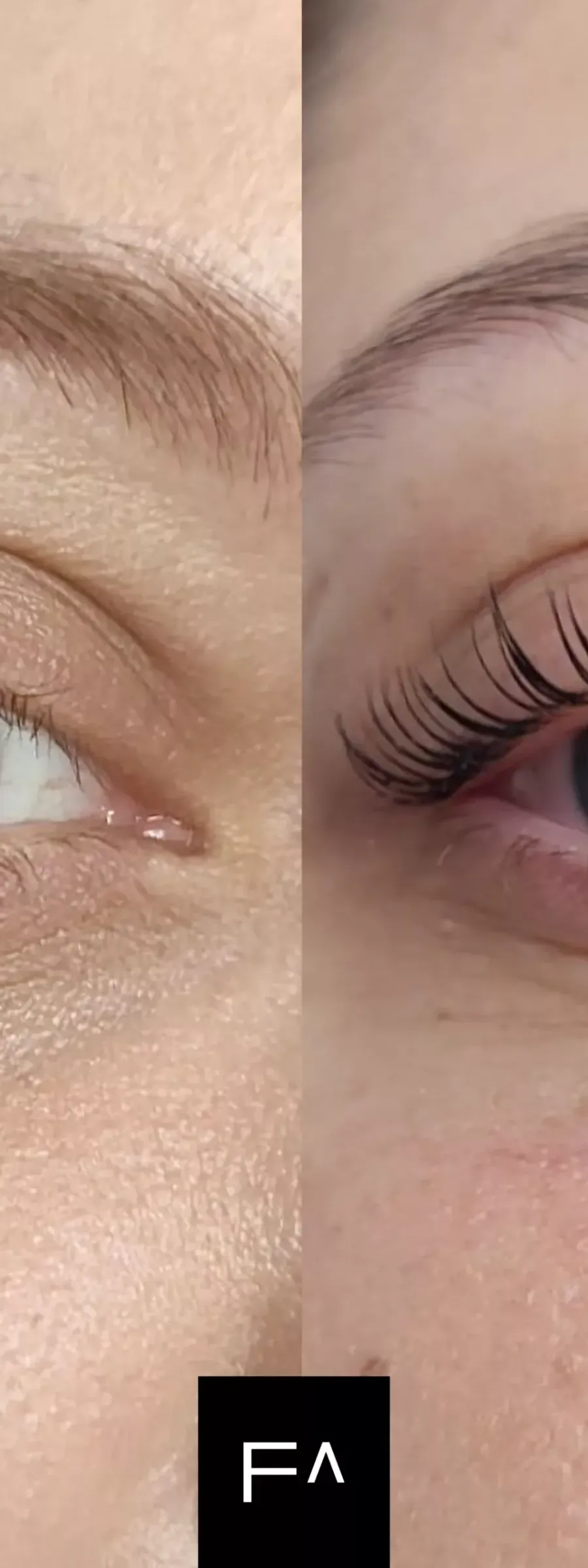 πριν και μετά Lash Lift : Τι είναι, Πόσο διαρκεί και πόσο κοστίζει; στα μάτια