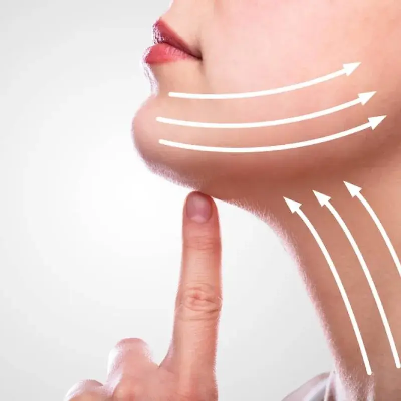 FaceTite: Face and Neck Tightening and Lifting
