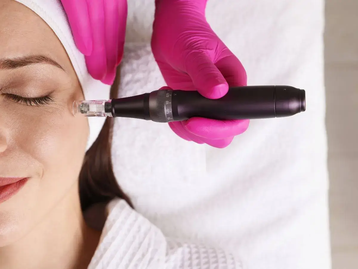 Dermapen on a woman's eyes for a facial treatment.