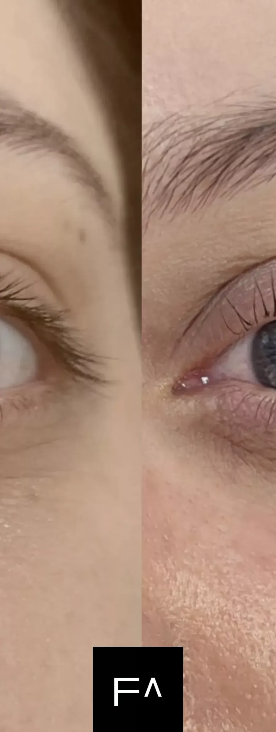 πριν και μετά Lash Lift : Τι είναι, Πόσο διαρκεί και πόσο κοστίζει; στα μάτια