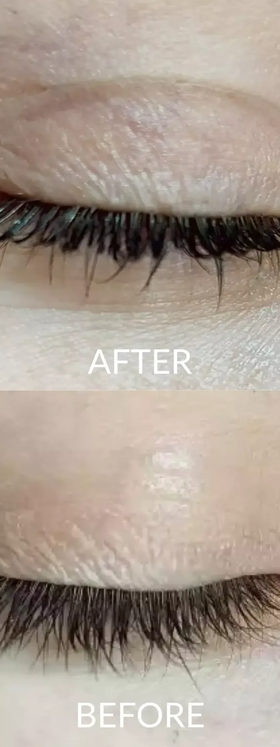πριν και μετά Lash Lift : Τι είναι, Πόσο διαρκεί και πόσο κοστίζει; στα μάτια