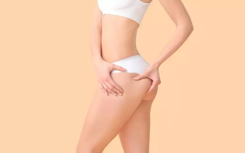 what is the best treatment for cellulite