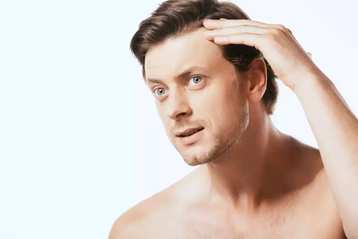 Alopecia