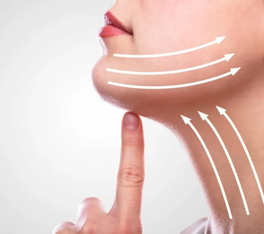 Woman's chin and neck with arrows showing upward lift, representing Treatments for Double Chin.
