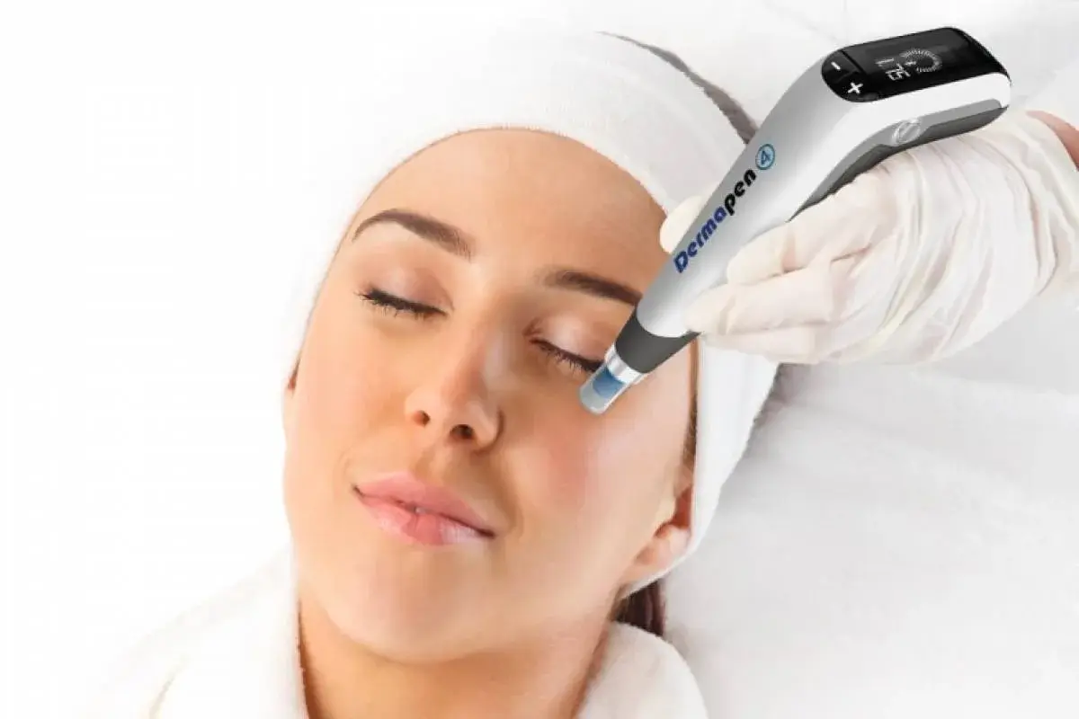 Dermapen Microneedling: Prices, Procedure, Before and After: application on a woman's face