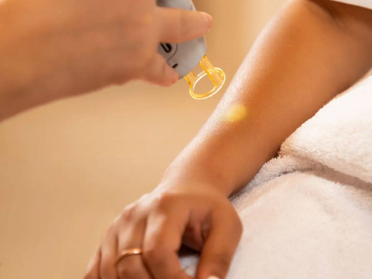 Laser Hair Removal for Arms: Everything You Need to Know