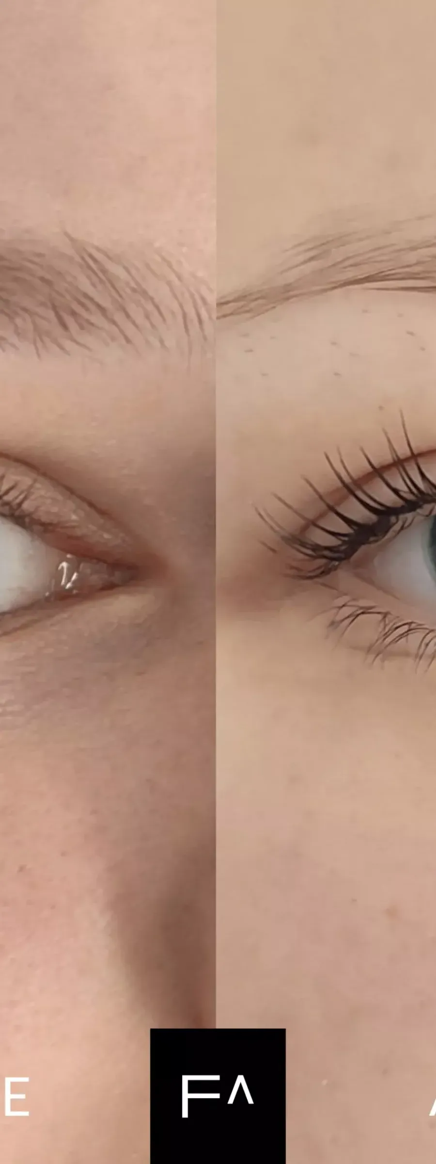 πριν και μετά Lash Lift : Τι είναι, Πόσο διαρκεί και πόσο κοστίζει; στα μάτια