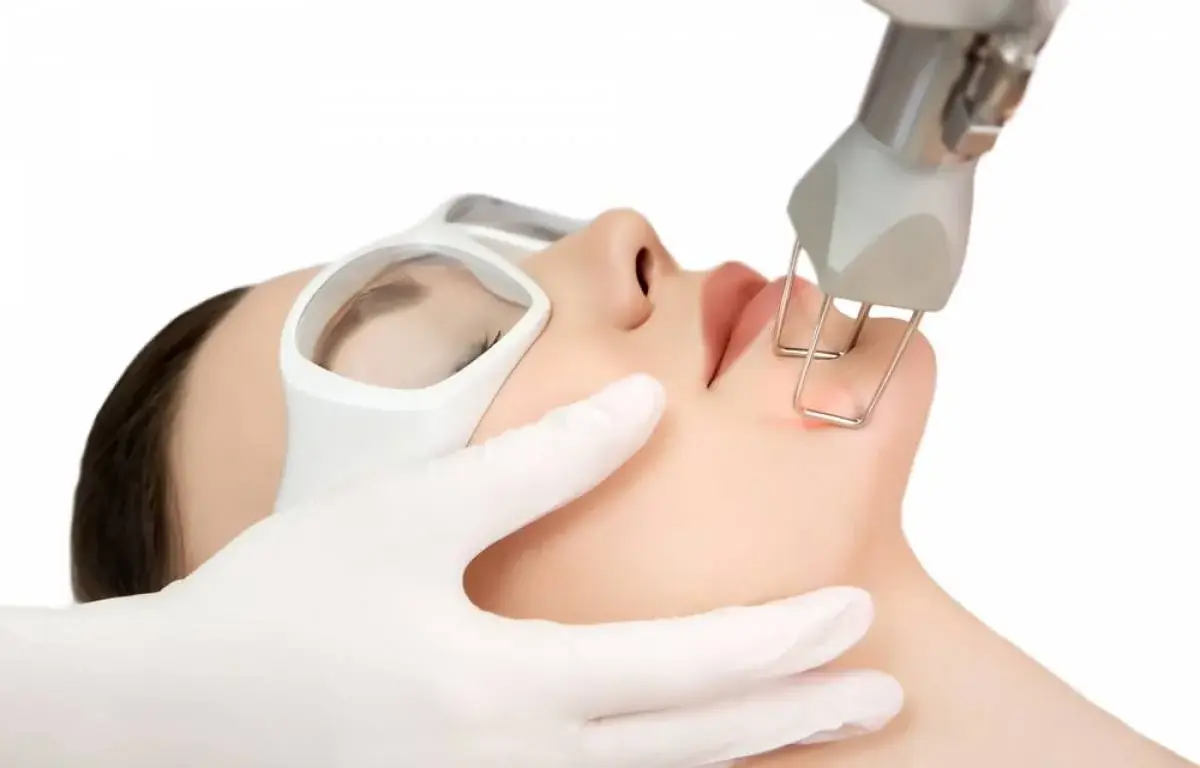 Fractional Laser: Ανάπλαση Επιδερμίδας
