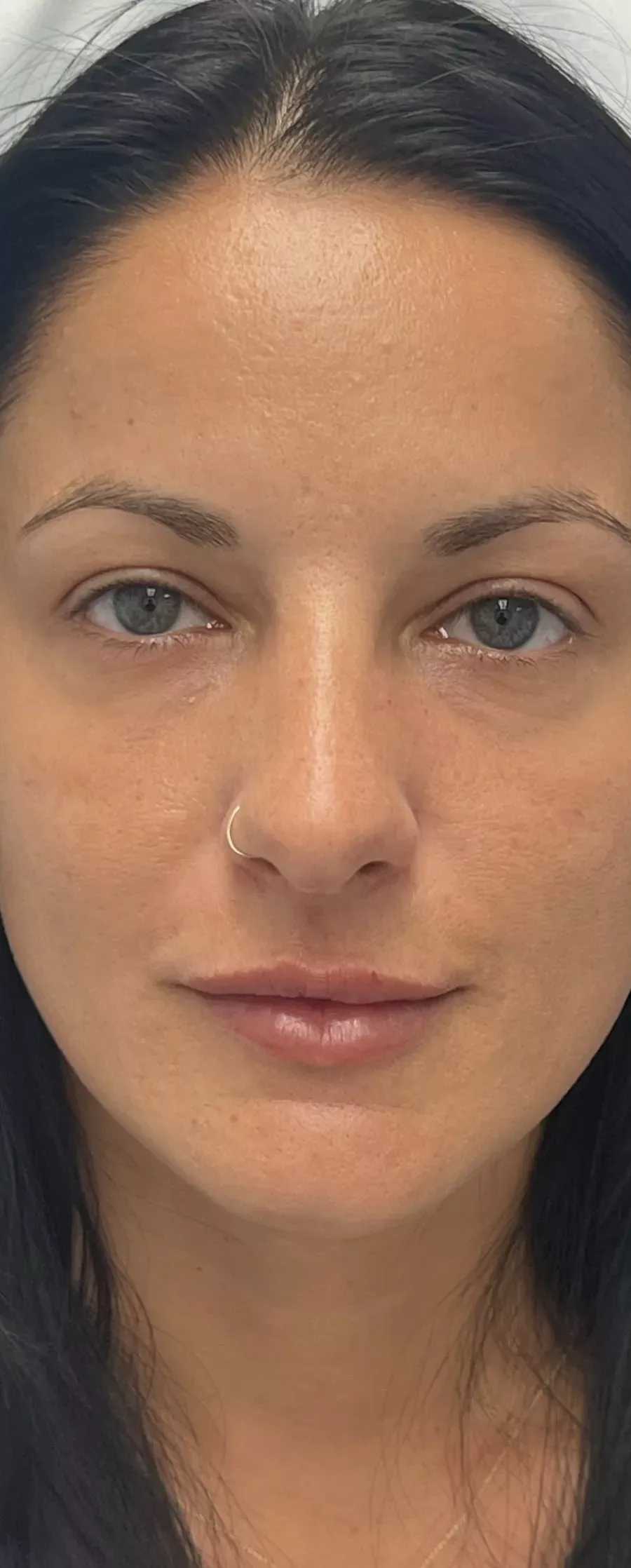 Beautification — after