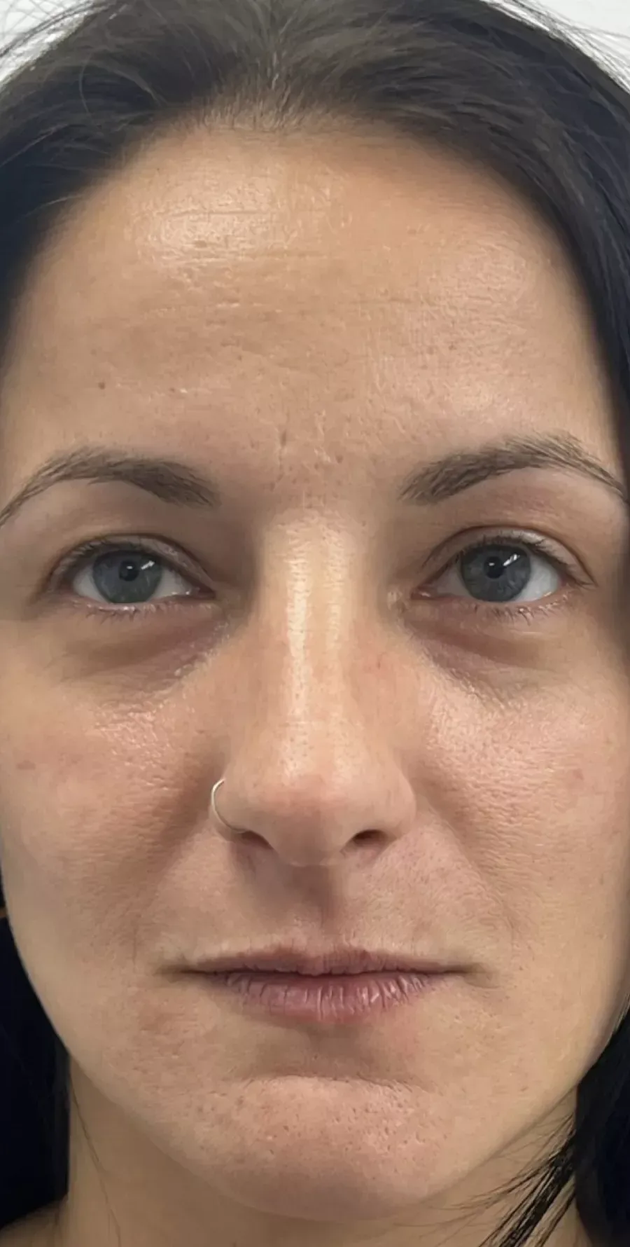 Case 1 — before