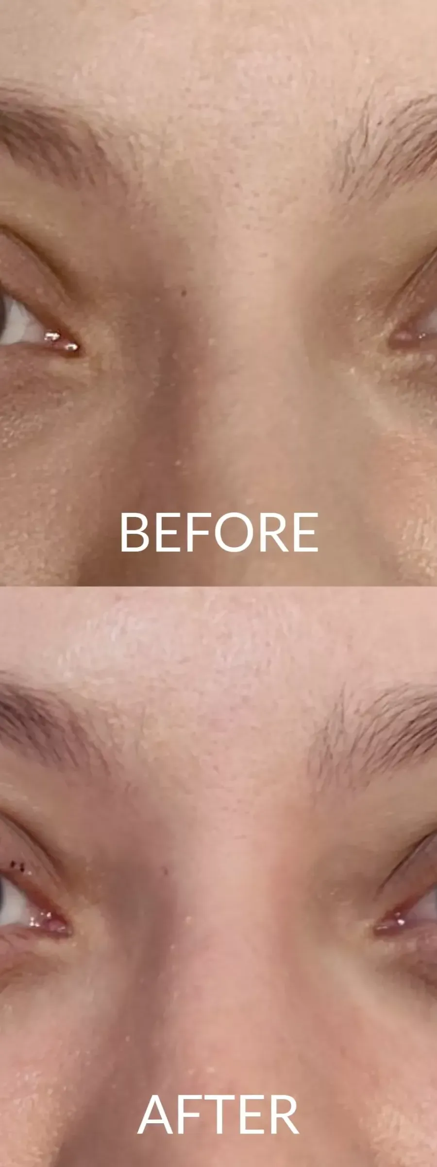 πριν και μετά Lash Lift : Τι είναι, Πόσο διαρκεί και πόσο κοστίζει; στα μάτια