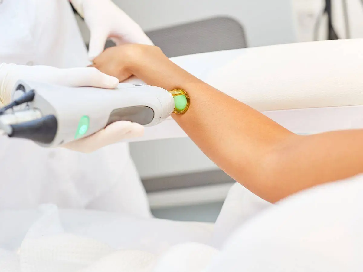 Laser Αποτρίχωση: Τι Πρέπει να Ξέρω Πριν Ξεκινήσω