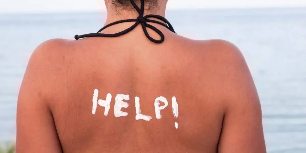 Ηλιακό Έγκαυμα στην πλάτη με την επιγραφή "HELP!" γραμμένη με αντηλιακό