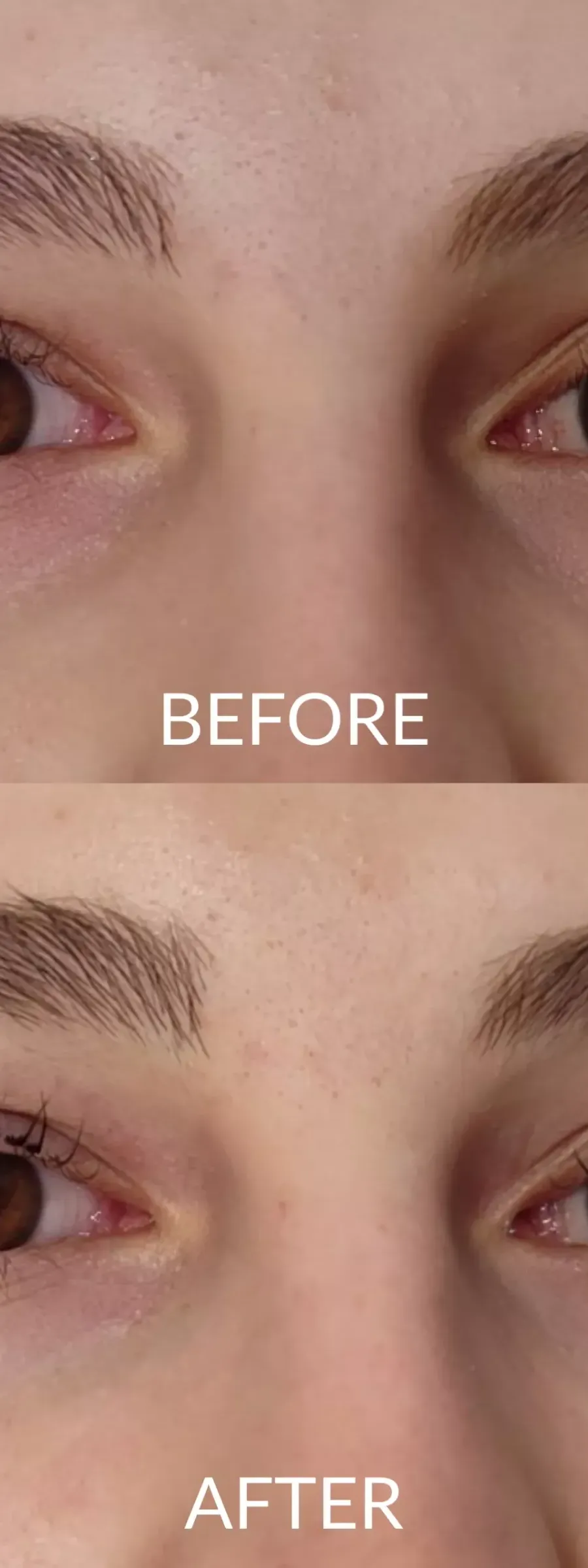 πριν και μετά Lash Lift : Τι είναι, Πόσο διαρκεί και πόσο κοστίζει; στα μάτια μιας γυναίκας