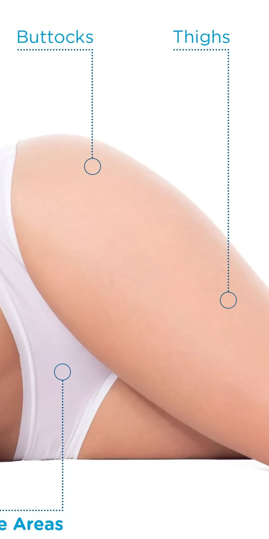 Σημεία Εφαρμογής της Exilis Elite