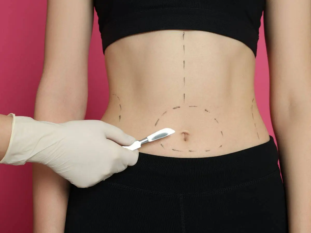 Swelling after liposuction: What to expect
